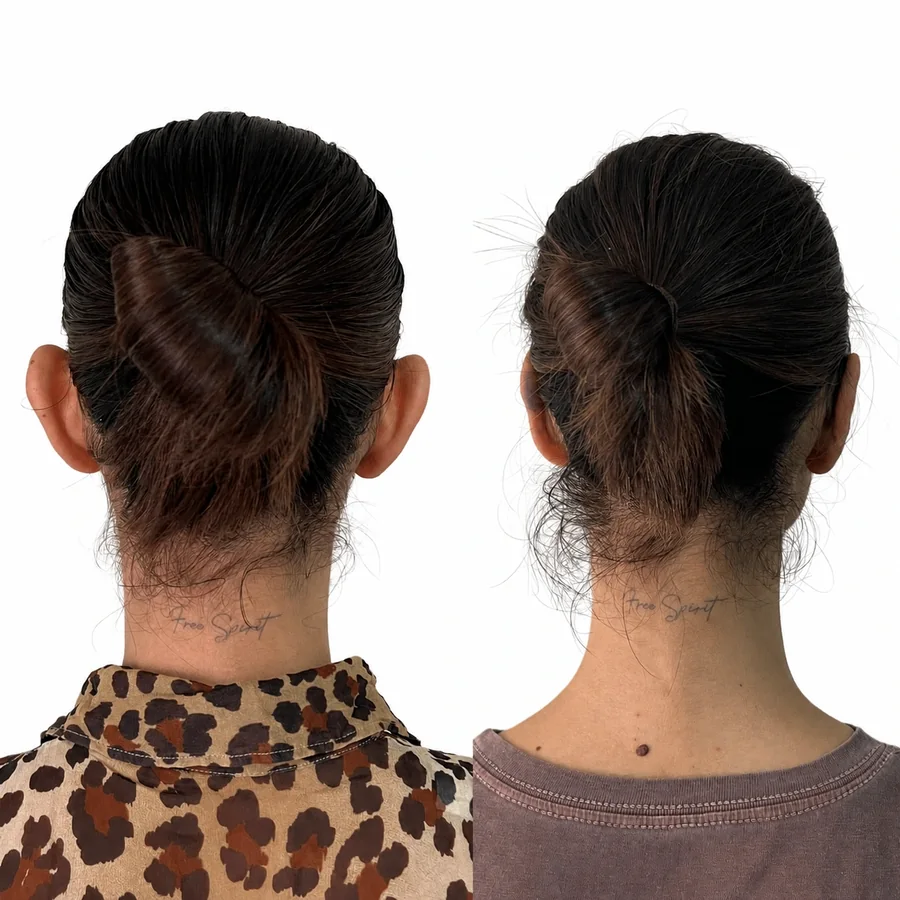 Comparativo de antes e depois de otomodelação — caso 07